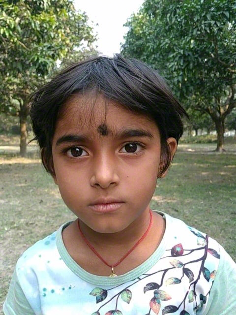 World Vision India
